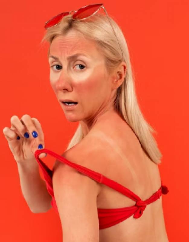 What to do (and what not to do) if you get a sunburn
